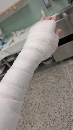 Gips.jpg